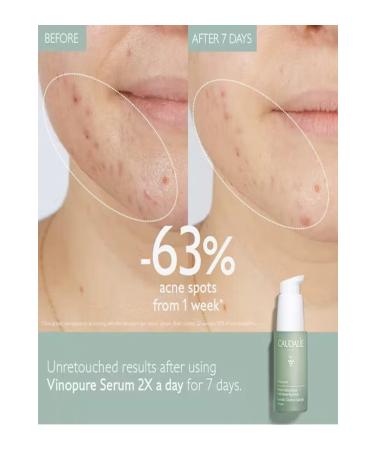 Caudalie VINOPURE SR Serum 30ML - Buy Online on GoSupps.com