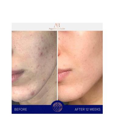 Augustinus Bader AB The Cream Moisturizing Cream 50 ml - Buy Online on GoSupps.com