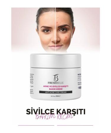 FreshBelle Anti-Acne and Anti-Pimple Acne Blackhead Remover Cream 50 ml