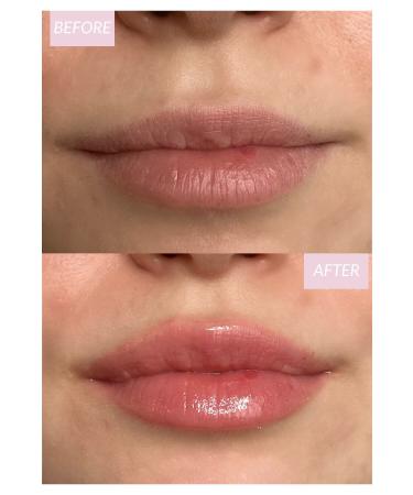 weem Glossy Plump Lip Oil - Calendula - Buy Online on GoSupps.com