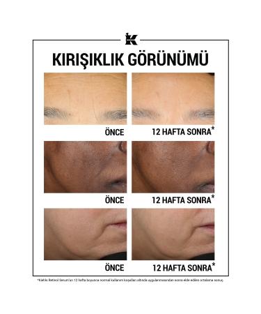 Kiehl's Anti-Wrinkle Daily Serum with Retinol to Reduce Signs of Aging 30ml - Buy Online on GoSupps.com