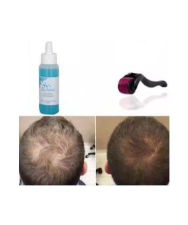 Purexpose Hair Serum Hair Growth Helping Hair Nourishing Visualizing Lotion 1 Dermaroller