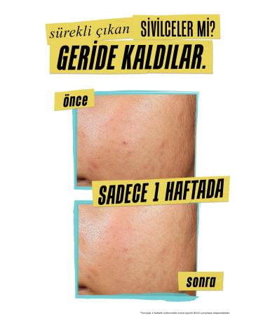 Kiehl's Acne Reducing and Preventing Care Cream with 1.2% Salicylic Acid and 2% Niacinamide.60ml - Buy Online on GoSupps.com