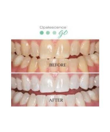 Opalescence Ultradent Go 20-Pack Mint Pre-Packed Teeth Whitening - Buy Online on GoSupps.com