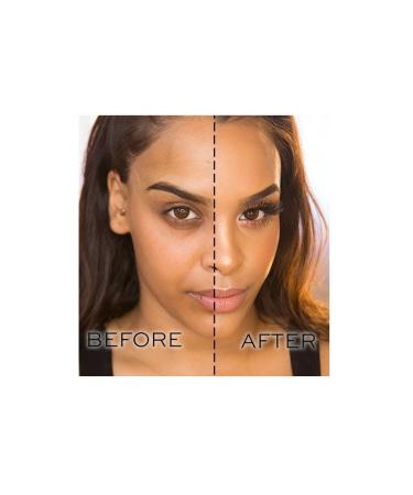 Revolution SK NCARE DARK SPOT CORRECTOR CORRECTIVE SK N BR GHTEN NG CLARIFY NG SK N SERUM 30ML GKH R408