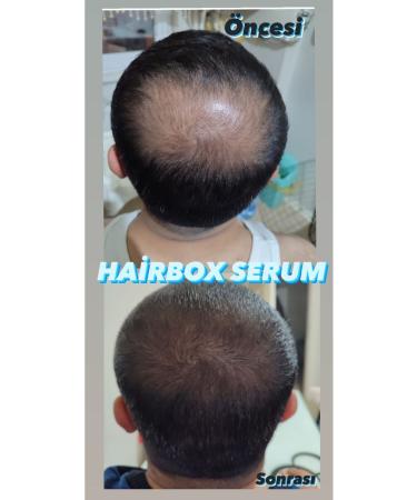 hairbox professional hair care products Men's Hair Serum Hair Serum Hair Thickener (3pcs Serum Dermaroller) - Buy Online on GoSupps.com