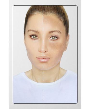 Svava Anti-Blemish Skin Tone Equalizer Brown Dark Spot Anti-Spot Serum 30ml - Buy Online on GoSupps.com