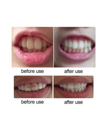 GELLO 2-Pack Teeth Whitening Gel (2 Pieces) - Buy Online on GoSupps.com