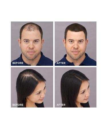 LORENTI Keratin Hair Thickener Hair Fibers Black Topic 27.5 G - Buy Online on GoSupps.com