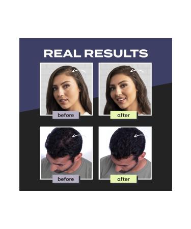 LORENTI Keratin Hair Thickener Hair Fibers Black Topic 27.5 G - Buy Online on GoSupps.com