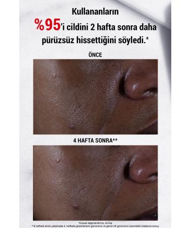 Kiehl's PORE TIGHTENING SMOOTHING SKIN BRIGHTENING FACE SERUM 30 ML KEYON1983 - Buy Online on GoSupps.com