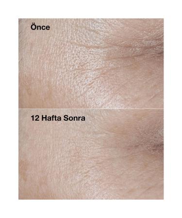 Clinique Smart Clinical Repair - SPF 30 Face Cream 50ml - Buy Online on GoSupps.com