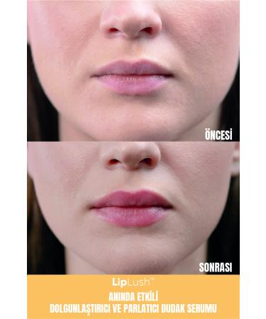LipLush Long-lasting Plumping and Shining Lip Serum - Buy Online on GoSupps.com