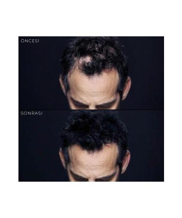 Toppik 3 gr (TRIAL SIZE) Hair Volumizing Keratin Fiber Red - Buy Online on GoSupps.com