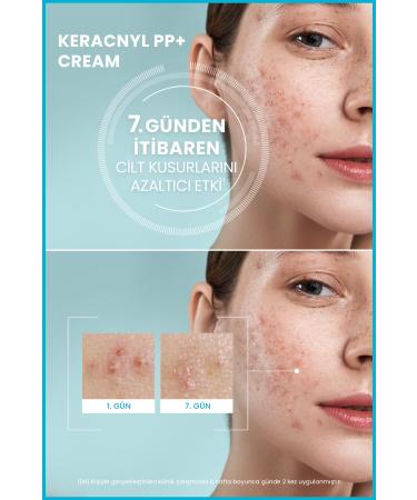 Ducray Keracnyl PP+ Cream Care Cream for Oily and Acne Prone Skin 30ml - Buy Online on GoSupps.com