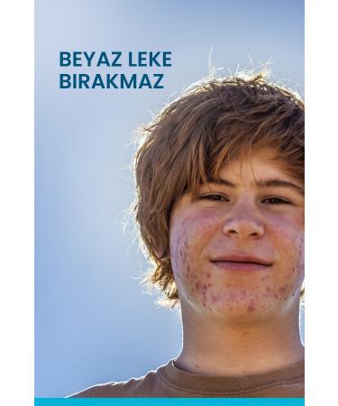 Ducray Keracnyl Fluid SPF 50+ Sunscreen for Oily and Acne Prone Skin 50ml - Buy Online on GoSupps.com