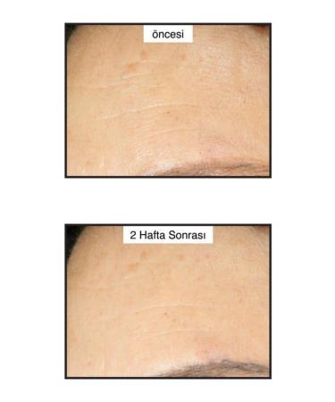 Murad RETINOL NIGHT MOISTURIZER - RETINOL YOUTH RENEWAL NIGHT CREAM 50 ML KEYON2221 - Buy Online on GoSupps.com