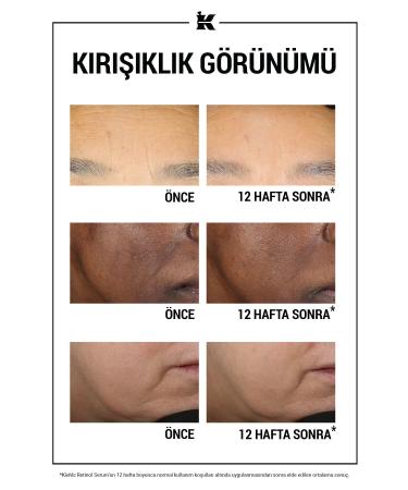 Kiehl's DERMATOLOGIST SOLUTIONS BR GHTENING-SH NING SERUM WITH RETINOL 50 ML KEYON2709 - Buy Online on GoSupps.com