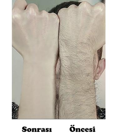 Izla Hair Removal Sponge & Depilatory Sponge - Buy Online on GoSupps.com