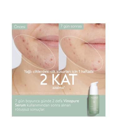 Caudalie V NOPURE SKIN BARRIER REPAIRING SALICYLIC SERUM 30 ML DEMBA4141 - Buy Online on GoSupps.com