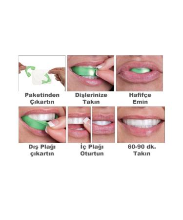 Opalescence Ultradent Go 20-Pack Mint Pre-Packed Teeth Whitening - Buy Online on GoSupps.com
