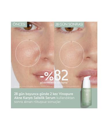 Caudalie V NOPURE BR GHTENING-SH NING SALICYLIC SERUM 30 ML DEMBA4135 - Buy Online on GoSupps.com