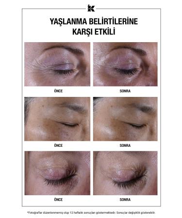 Kiehl's ANTI-DARK CIRCLE & ANTI-WRINKLE 7 EFFECTS IN ONE ANTI-FINE LINE EYE CREAM 14 ML DEMBA4322 - Buy Online on GoSupps.com