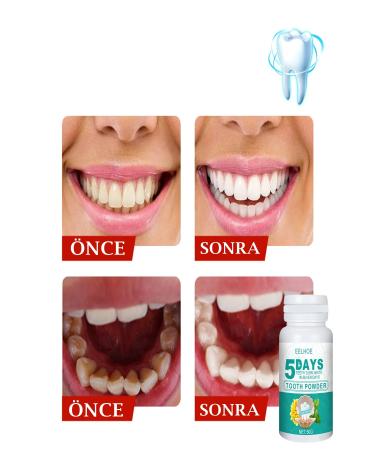 Xolo Teeth Whitening Powder Active Carbon 50 Gr Tooth Powder 5 Days USA - Buy Online on GoSupps.com