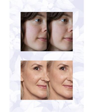 NONI Facial Care Oil (Wrinkle and Blemish Repairing Skin Care Oil Serum) - Buy Online on GoSupps.com