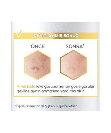 NIVEA N vea Luminous630 Anti-Spot Brightening Skin Care Serum 30 ml - Buy Online on GoSupps.com