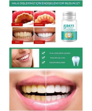 Xolo 5 Days Professional Teeth Whitening Effective Oral Care Teeth Whitening Powder - Buy Online on GoSupps.com