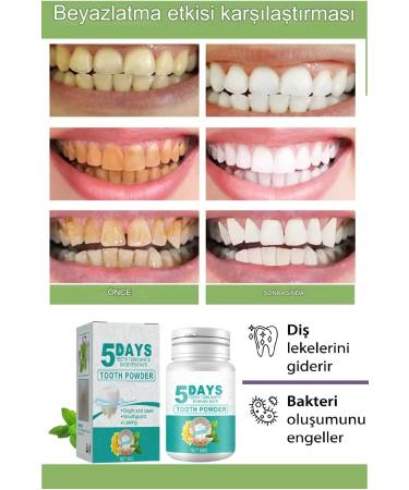 Xolo 5 Days Professional Teeth Whitening Effective Oral Care Teeth Whitening Powder - Buy Online on GoSupps.com