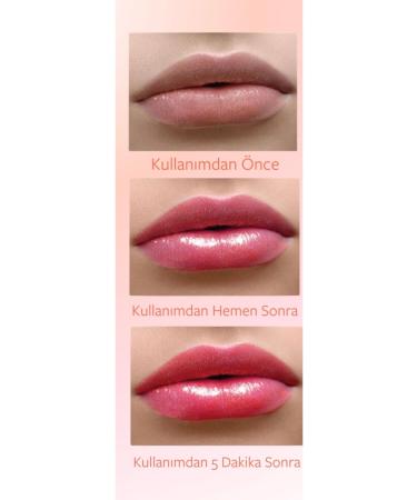 Derma clinic Color Changing Lipgloss Enriched with Hyaluronic Acid - Buy Online on GoSupps.com