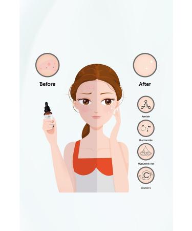 New Essentials Super Serum That Helps to Even Out Tone Clear Pores Blackheads and Acne - Buy Online on GoSupps.com