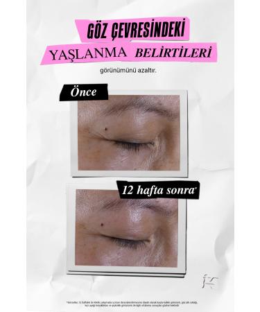 Kiehl's Super Multi Corrective Antiaging Eye Cream - Anti-Wrinkle & Anti-Dark Circle Care 14 Ml - Buy Online on GoSupps.com