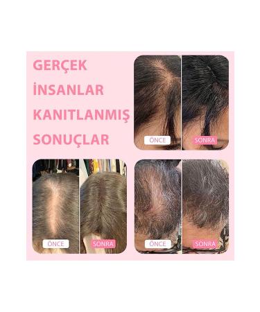 Boldify Hair Building Fibers Topical Powder Dark Brown 28gr- Hair Building Fibers - Buy Online on GoSupps.com