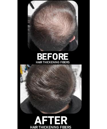 Boldify Hair Building Fibers Topical Powder Dark Brown 28gr- Hair Building Fibers - Buy Online on GoSupps.com