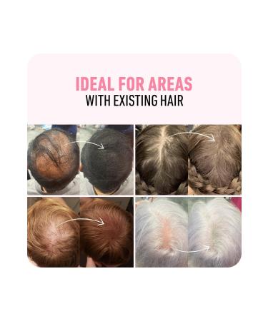 Boldify Hair Building Fibers Topical Powder Dark Brown 28gr- Hair Building Fibers - Buy Online on GoSupps.com