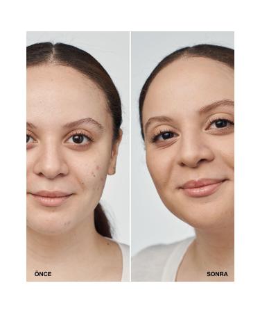 Clinique CN 52 NEUTRAL - EVEN BETTER CLINICAL INTENSE COLOR AND P GMENTED SERUM FOUNDATION SPF 20 PSSN2793 - Buy Online on GoSupps.com