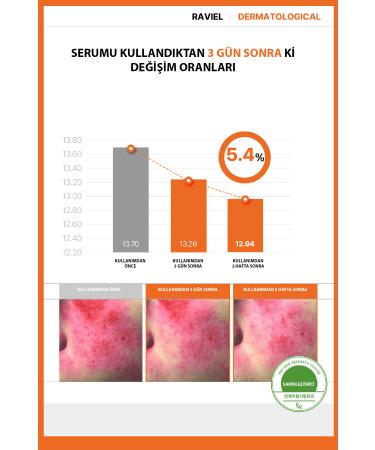 RAVIEL JUST ENOUGH Multivitamin Dark Spot Blemish Serum with Vita C for Dark Spots - Buy Online on GoSupps.com