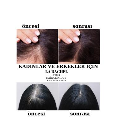 La Rachel Scientific Hair Serum that Provides New Hair Formation with Patented Content Against Hair Loss - Buy Online on GoSupps.com