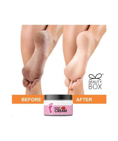 Beauty Box Anti-Fungus Protection Bad Odor Preventive Heel Crack Gel Premium Foot Cream