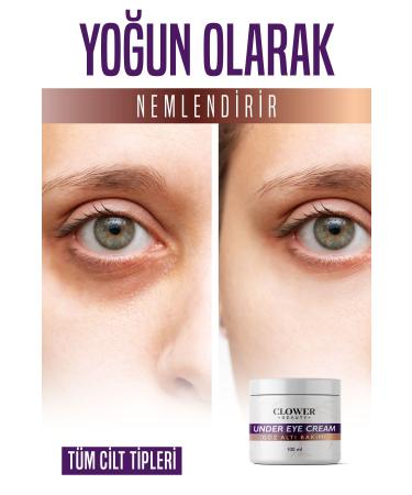 CLOWER BEAUTY Under Eye Bags Dark Circles & Anti-Wrinkle Brightening Under Eye Cream 100 ml - Buy Online on GoSupps.com