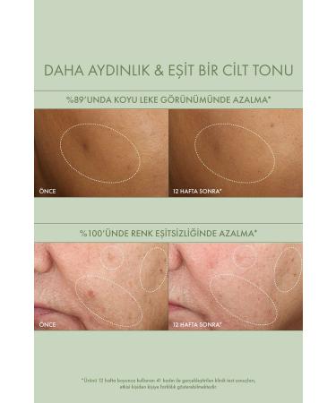 Origins DR. ANDREW WEIL FOR ORIGINS MEGA-MUSHROOM Anti-Dark Spot Serum 50 ml - Buy Online on GoSupps.com