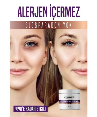 CLOWER BEAUTY Under Eye Bags Dark Circles & Anti-Wrinkle Brightening Under Eye Cream 100 ml - Buy Online on GoSupps.com