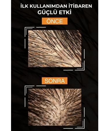 Zigavus Medicade Juniper Tar Shampoo Anti-Dandruff Dermatitis Flaking Itching Anti-Shampoo - Buy Online on GoSupps.com