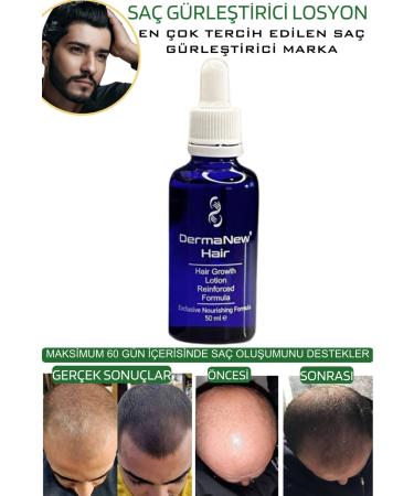 dermanew hair Dermanew Hair Lotion Hair Care Oil - Hair Thickener - Hair Serum / 5 Pieces Roller - Buy Online on GoSupps.com