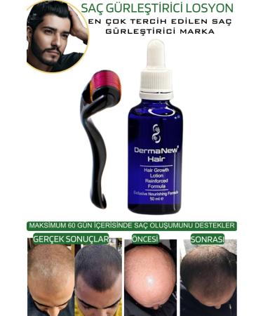 dermanew hair Dermanew Hair Lotion Hair Care Oil - Hair Thickener - Hair Serum / 5 Pieces Roller - Buy Online on GoSupps.com
