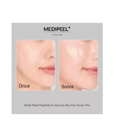 Medipeel MEDI-PEEL Peptide 9 Volume Bio Tox Toner PRO (250ml) - Buy Online on GoSupps.com