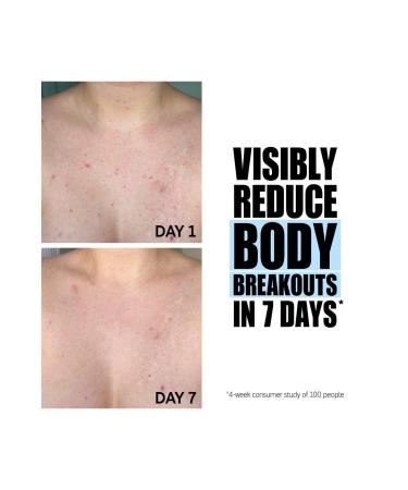 THE INKEY LIST Glycolic Acid Exfoliating Body Stick - Buy Online on GoSupps.com